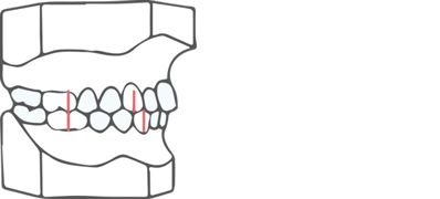 img-orto-1b