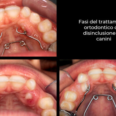 caso-clinico-7-6